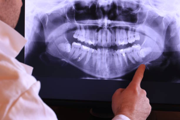 Best Emergency Gum Treatment in Lynbrook, NY