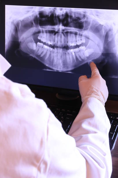 Best Emergency Denture Repair in Lynbrook, NY